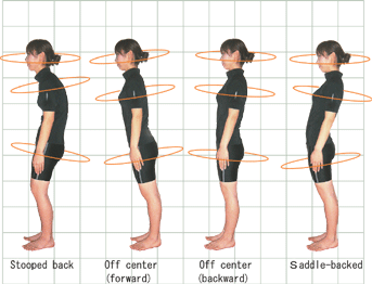 Axes disorders